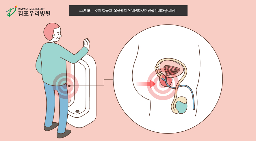 소변 보는 것이 힘든 중년 남성의 고민, 전립선비대증이란?